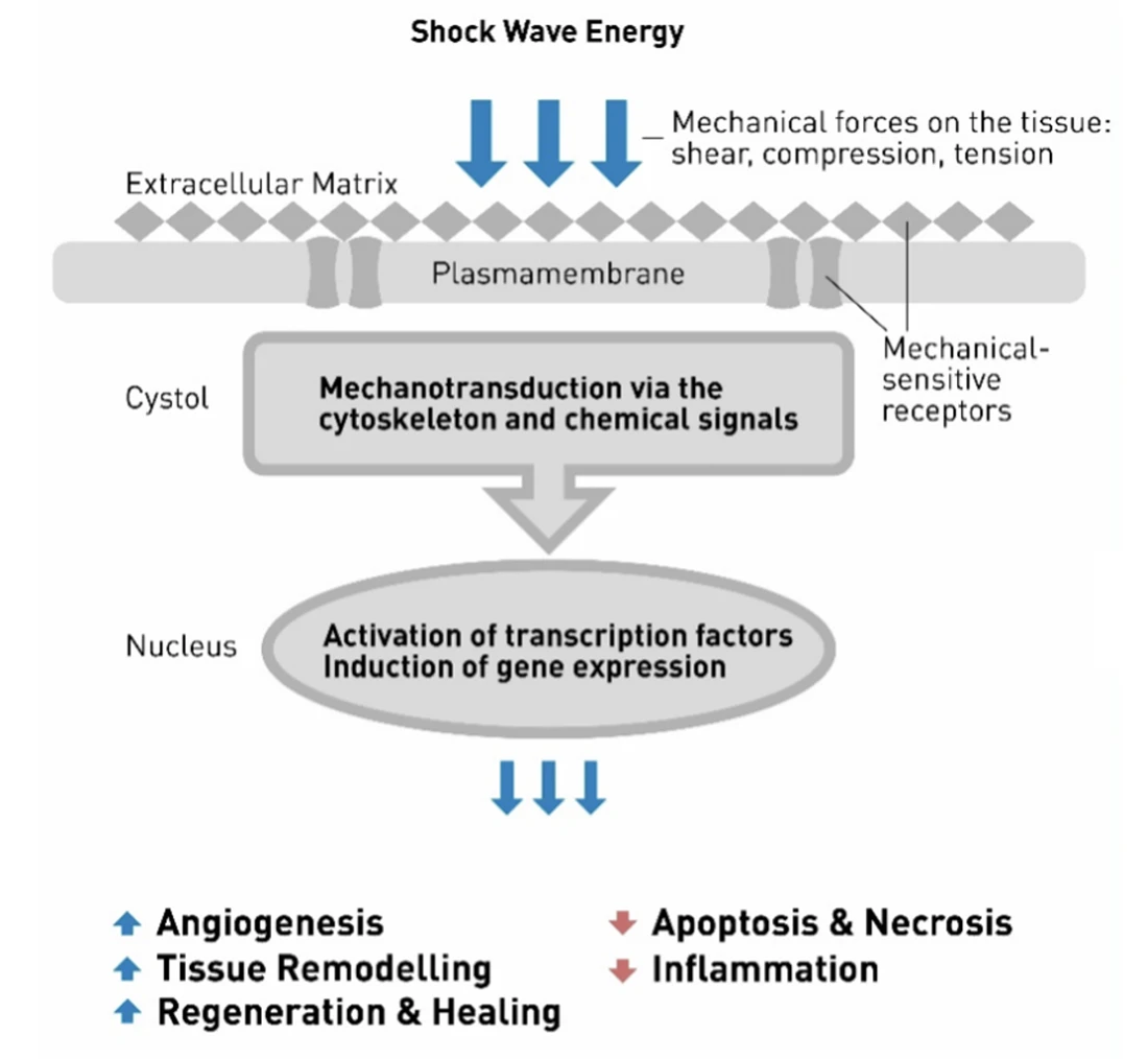 Chiropractic Omaha NE Shock Wave Energy Chart